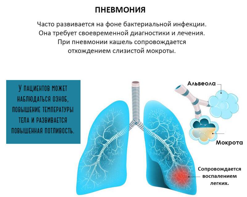 Затяжная пневмония – отличительные характеристики, как протекает, правила организации диагностики и лечения