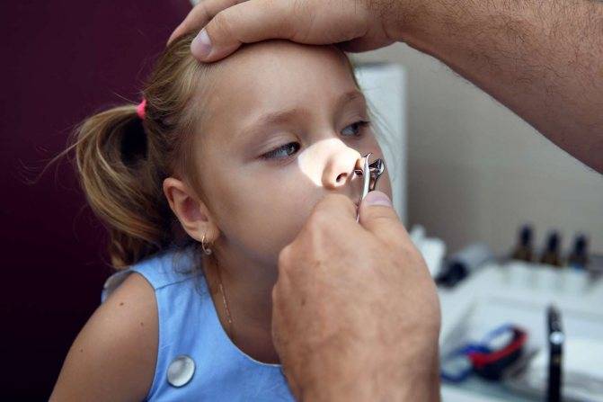 Аденоиды в носу у ребенка - лечение детей, симптомы, как лечить гайморит, что делать если не дышит и насморк