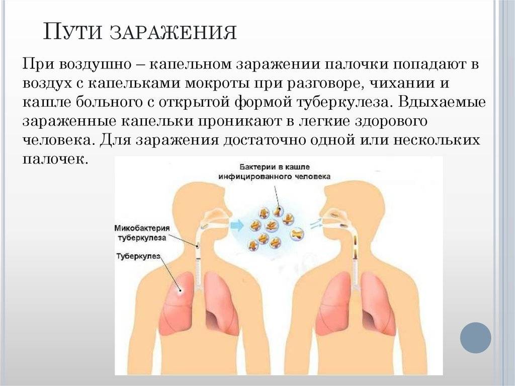 Как можно заразиться туберкулезом легких - как заражаются, как можно заболеть от больного человека, заражение чаще всего возможно на улице