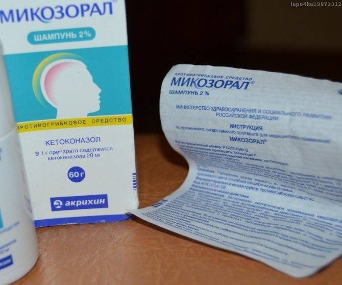 Лекарства от себореи: обзор противогрибковых препаратов (таблетки, лосьоны) от себорейного дерматита кожи головы