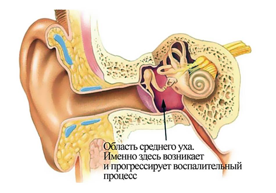 Болит ухо после орви: что делать