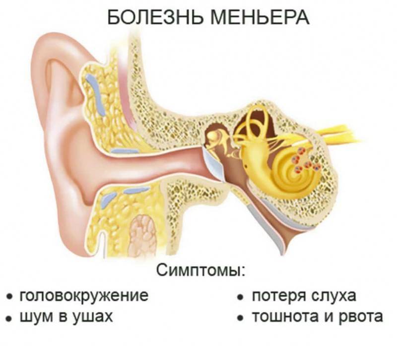Что делать если заложило ухо при сморкании - лечение24