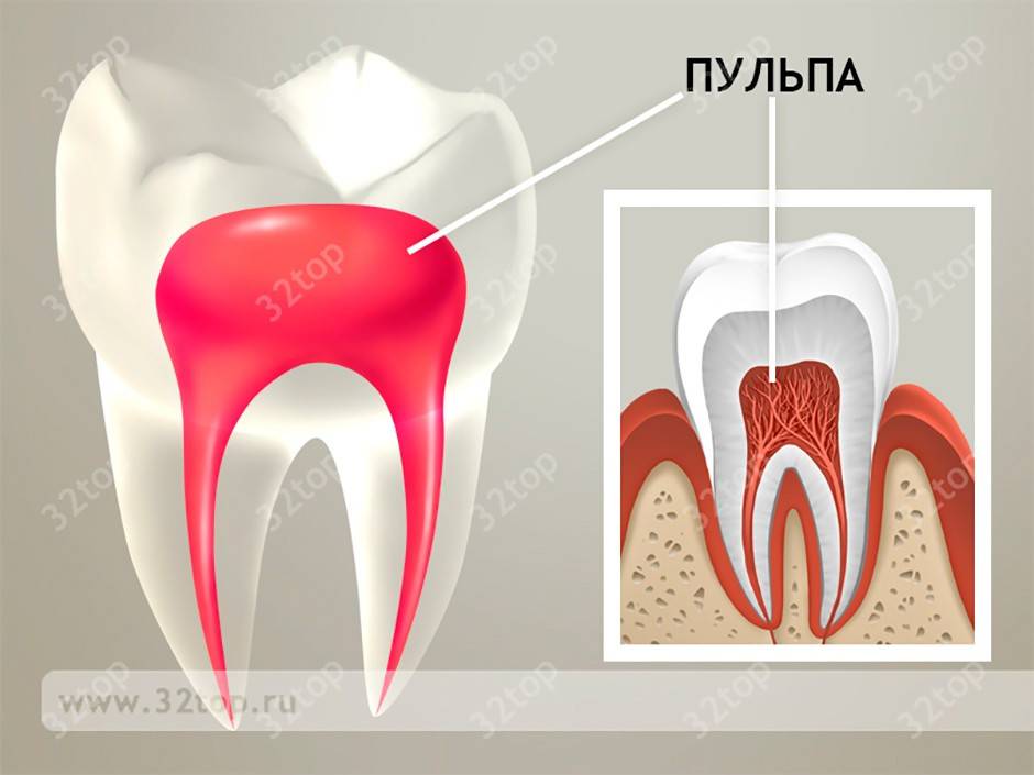 Депульпация зуба перед протезированием – цена и гарантия на процедуру