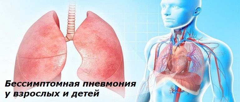 Пневмония симптомы у взрослых с температурой 39 без кашля и соплей