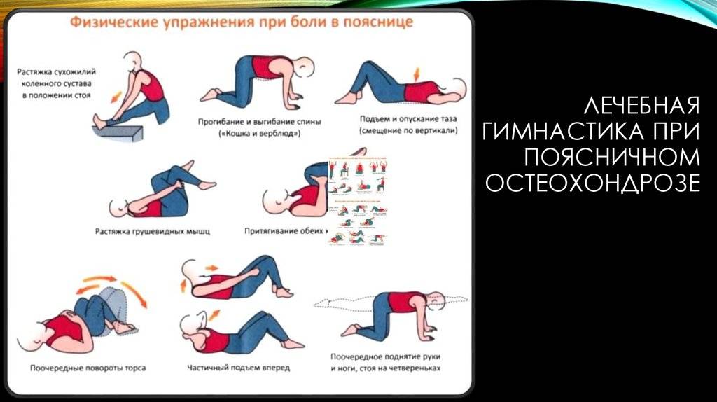 Лечебная гимнастика при остеохондрозе поясничного отдела позвоночника: комплексы физических упражнений