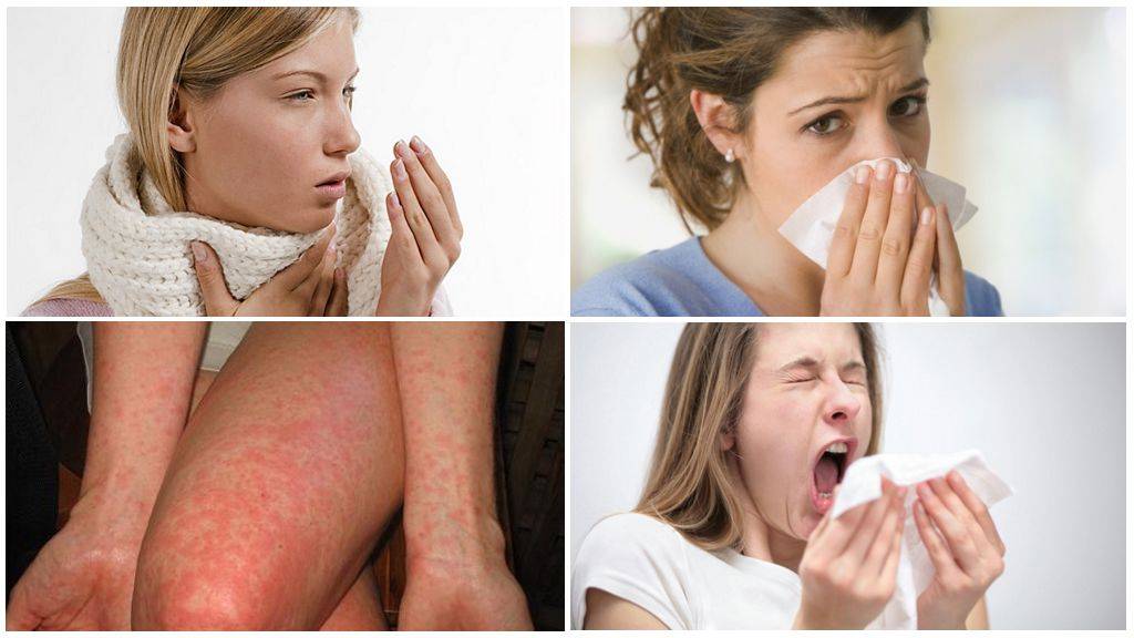 Аллергический кашель у ребенка: симптомы и лечение, чем и как лечить, препараты и народные средства.