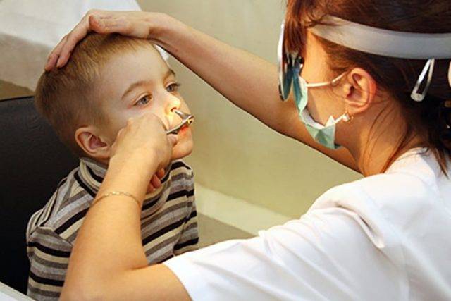 Комаровский: аденоиды 3 степени - лечение без операции у детей, как лечить в домашних условиях