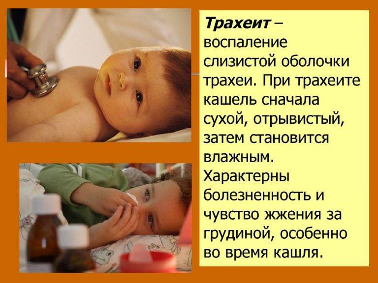 Трахеит у ребенка: симптомы и лечение / mama66.ru
