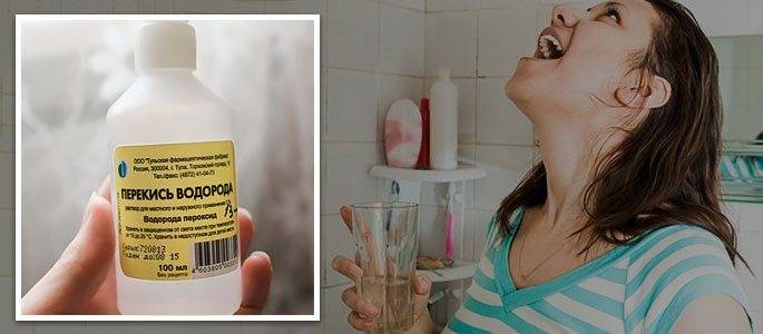 Пародонтоз: лечение в домашних условиях перекисью водорода и содой, лимоном - можно ли обрабатывать десну при пародонтите и воспалении