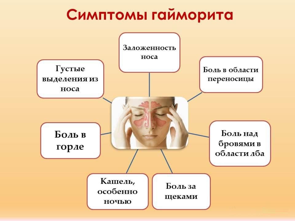 Гайморит: симптомы и лечение у взрослых