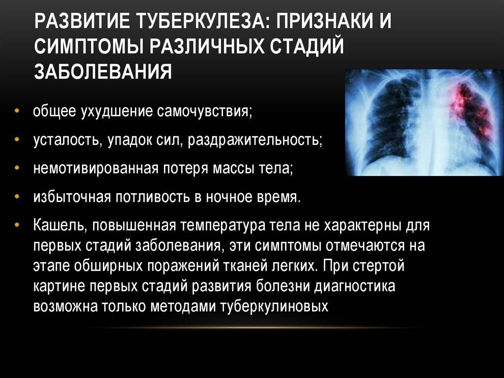 Что такое туберкулез легких, симптомы, первые признаки