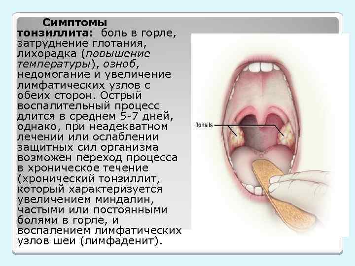 Болит горло с одной стороны при глотании с правой или слева, больно глотать и температуры нет, колющая и режущая боль в гландах