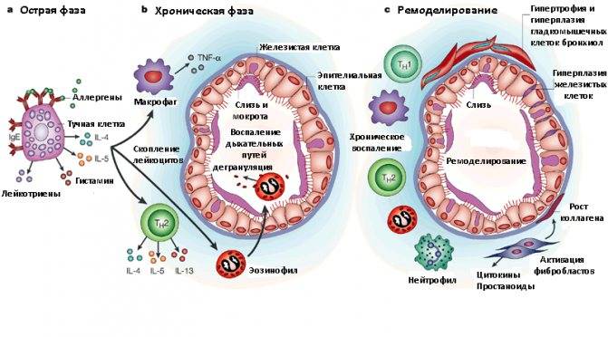 Виды и формы бронхиальной астмы