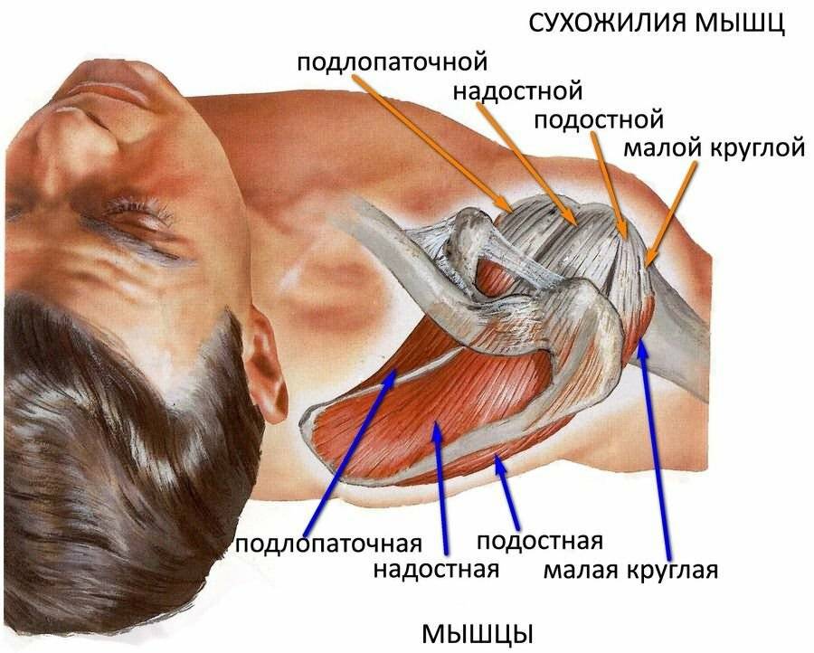 Тендиноз сухожилия надостной мышцы плечевого сустава - мирсуставов