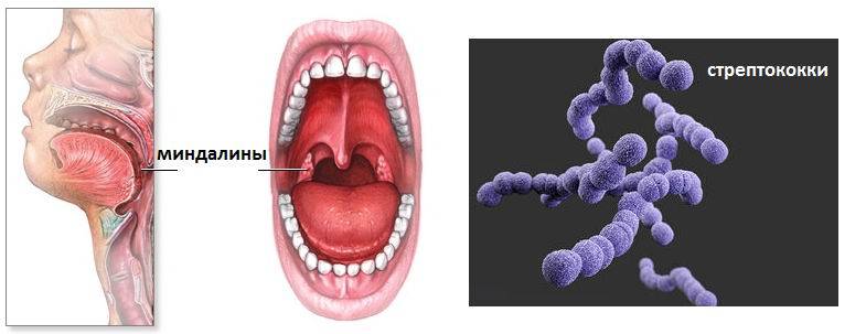 Стрептококковая инфекция у детей (60 фото): симптомы и лечение инфекции в горле, на коже и в носу, при ангине и пневмонии