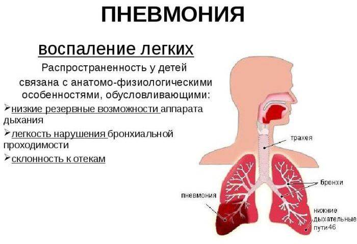 Последствия пневмонии в виде кашля