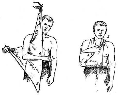 Упражнения после вывиха плечевого сустава для восстановления и укрепления