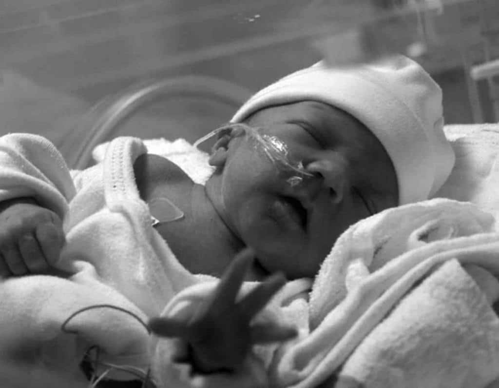Врожденная пневмония у новорожденных: причины и последствия