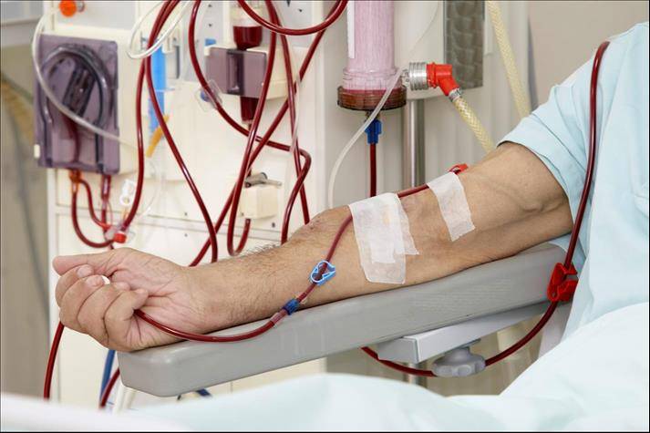 Плазмаферез: что это, показания и противопоказания к процедуре очистки крови