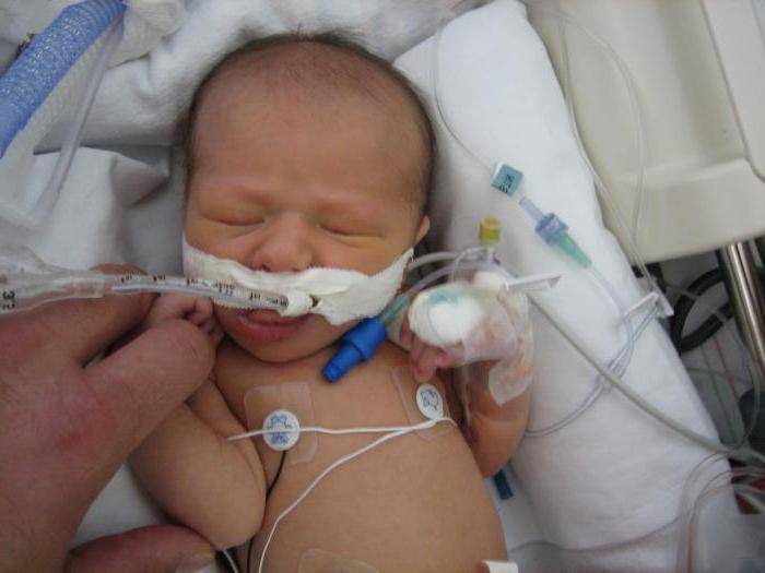 Пневмония у недоношенных новорожденных: сколько и как лечится, симптомы