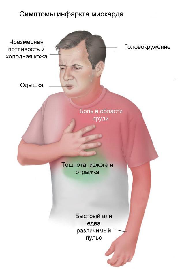 Сердечный кашель: симптомы и лечение при недостаточности сердца