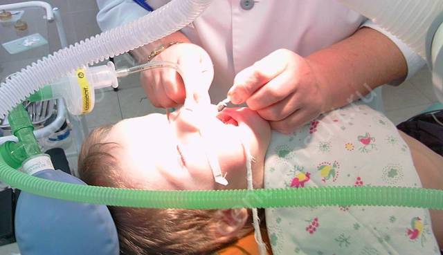 Современное лечение аденоидов рф у ребенка без операции: причины, степени и как удалять аденоид