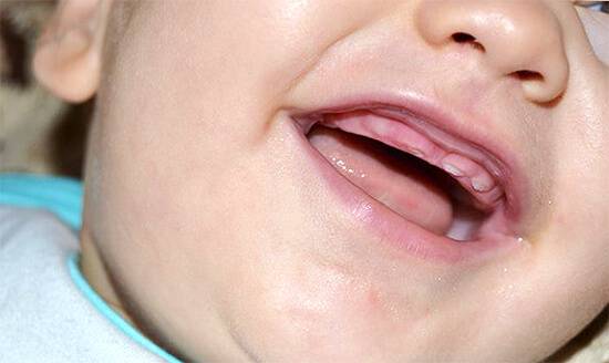 Кашель при прорезывании зубов, сопли у грудничков и детей старше: могут ли быть