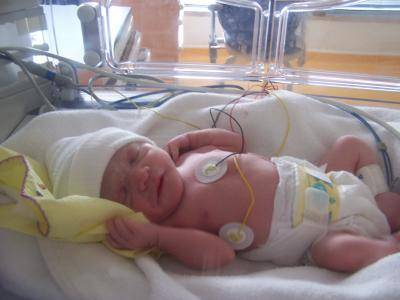 Внутриутробная пневмония у новорожденных: причины и последствия