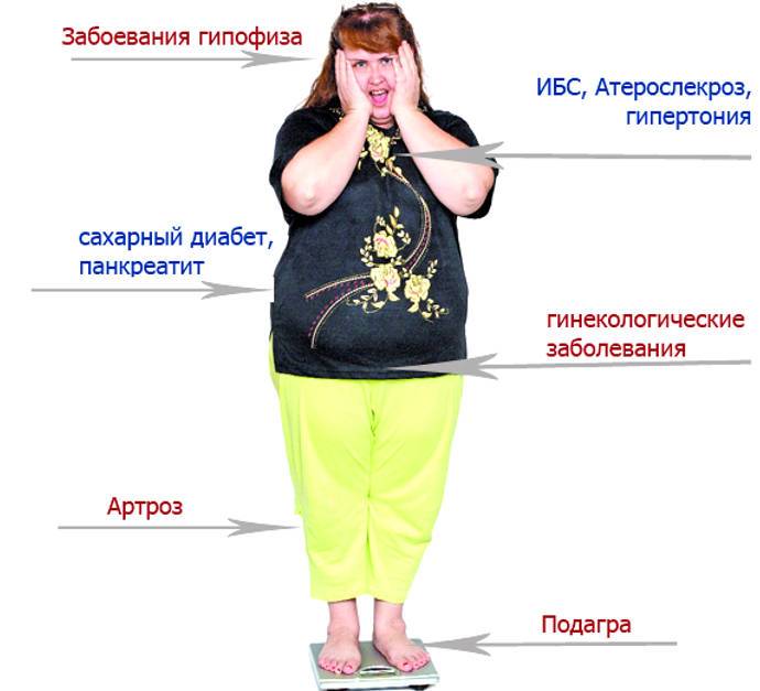 Гипоталамическое ожирение: что это такое, симптомы, диагностика, лечение