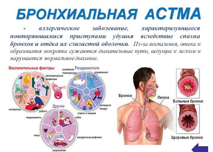 Туберкулез: причины заболевания и лечение
