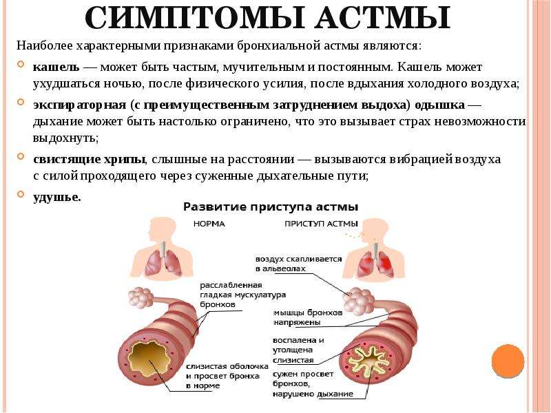 Астма лечится или нет? как победить астму