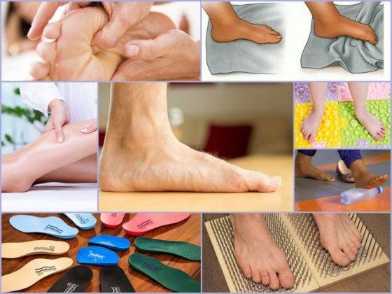Как избавиться от плоскостопия: массаж и полезные упражнения