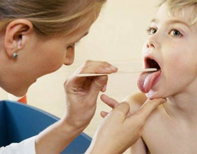 Острый тонзиллит у ребенка, симптомы и лечение острого тонзиллита у детей