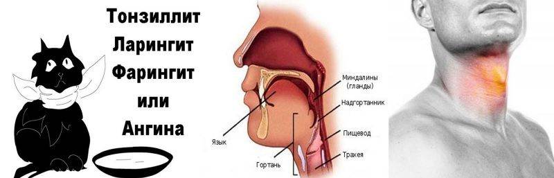 Болит горло с левой стороны при глотании