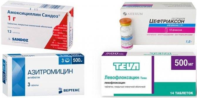 Таблетки от воспаления легких - лекарства от пневмонии, отхаркивающие средства для взрослых для лечения, какие препараты принимать