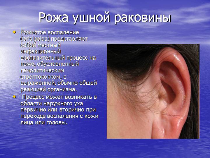 Наружный диффузный отит, как лечить диффузный отит наружного уха?