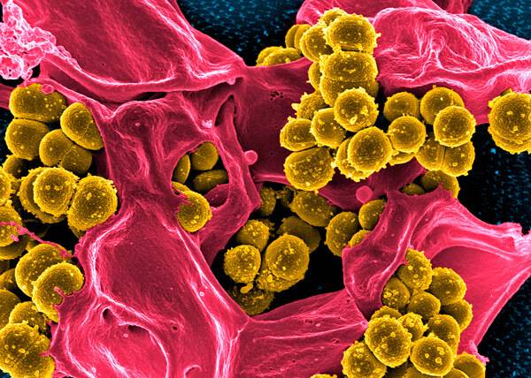 Бактериальная инфекция: понятие, особенности, течение, диагностика, терапия