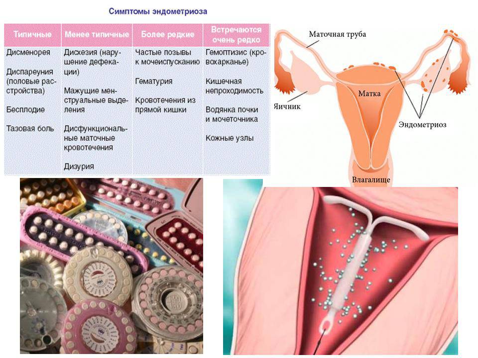 Препараты при климаксе при миоме и эндометриозе