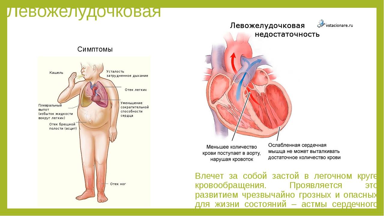 Неотложные состояния в кардиологии