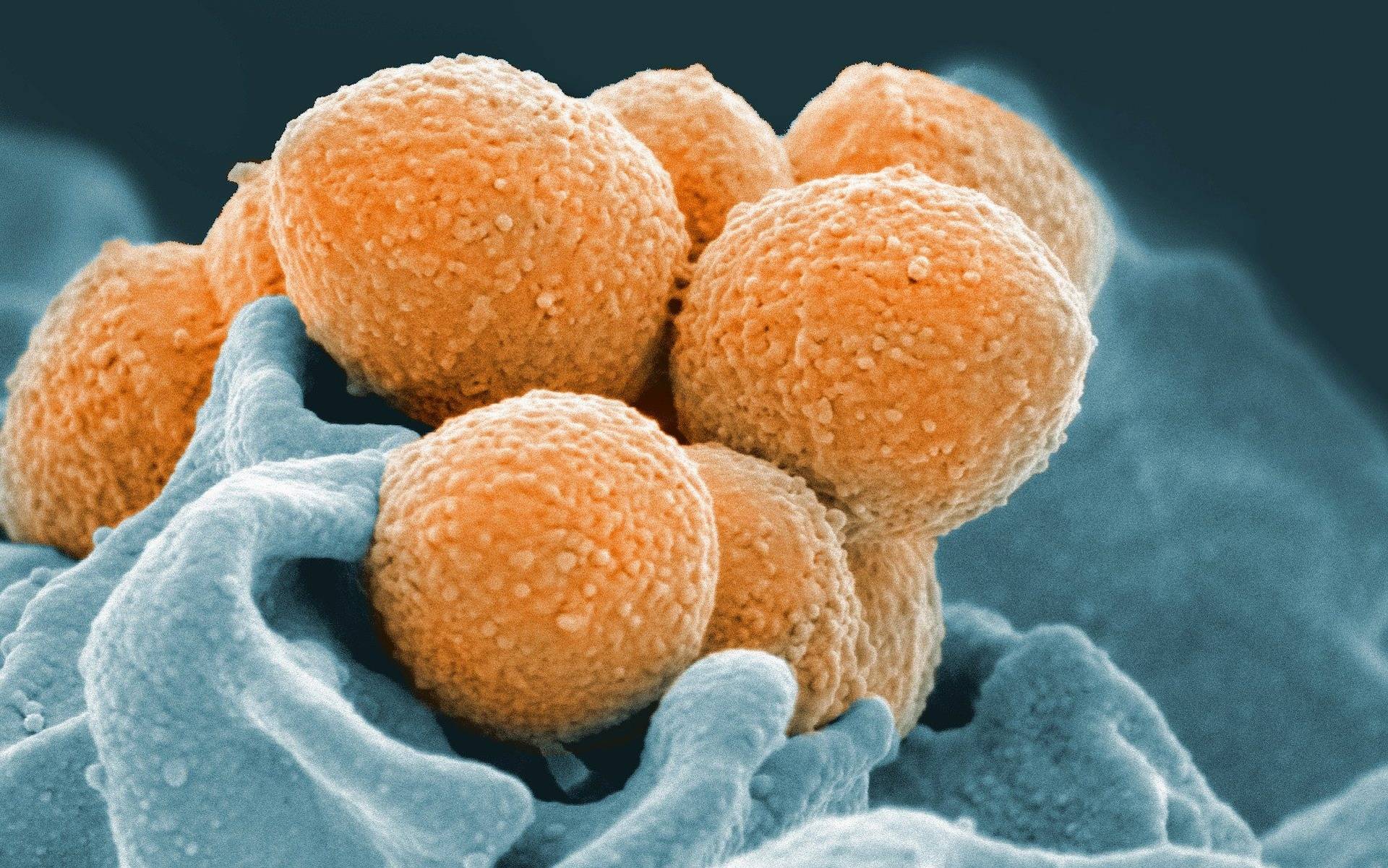 Бактерии и заболевания горла