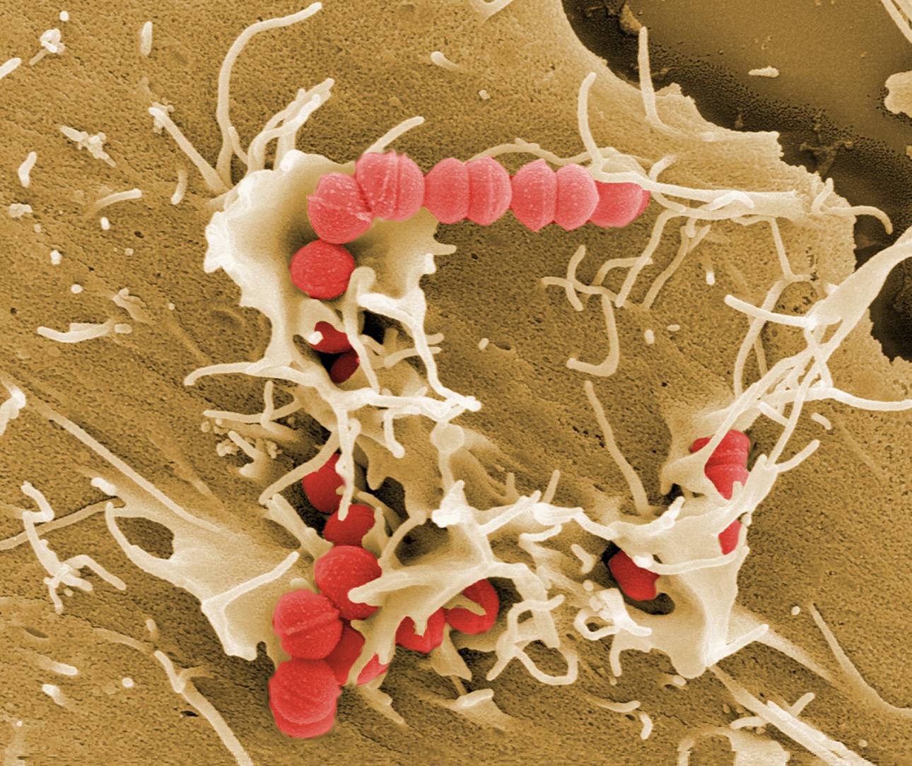Какие бактерии могут вызывать ангину?