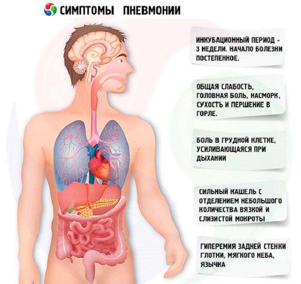 Симптомы пневмонии легких, признаки, лечение и виды
