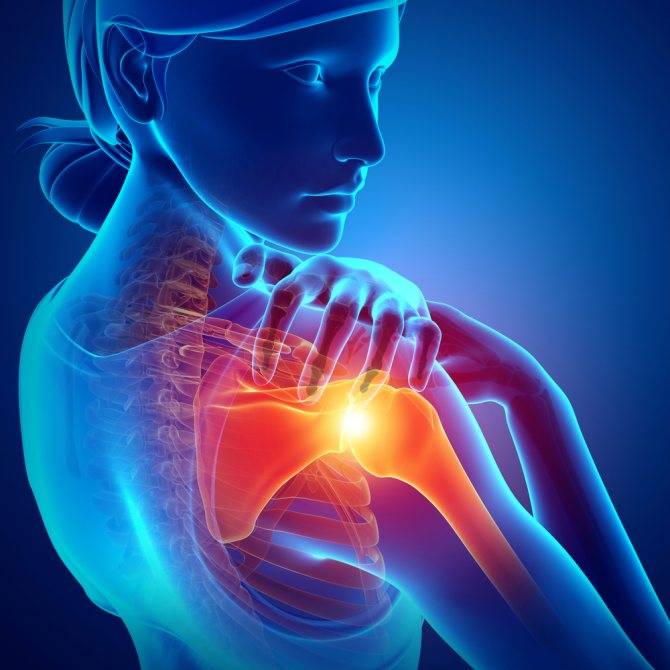 Методы лечения артроза плечевого сустава