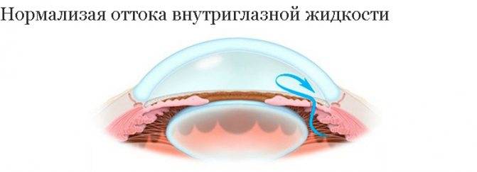 Лазерная иридэктомия: лечение глаукомы, как проводится, послеоперационный период и реабилитация