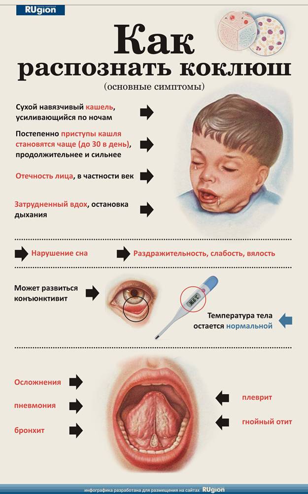 Лающий кашель с температурой у ребенка чем лечить: основные причины развития заболевания