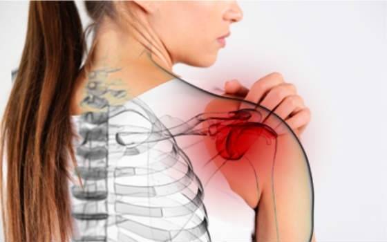 Плечевой периартрит лечение народными средствами | лечение суставов