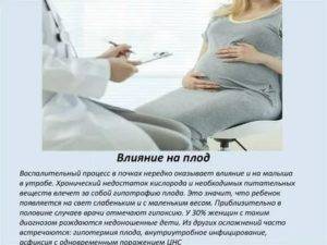 Тонзиллит при беременности: причины и лечение, последствия для ребенка