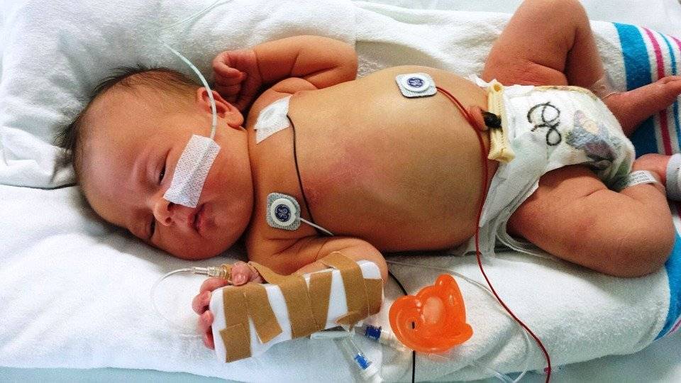 Внутриутробная (врожденная) пневмония у новорожденных детей: причины и лечение