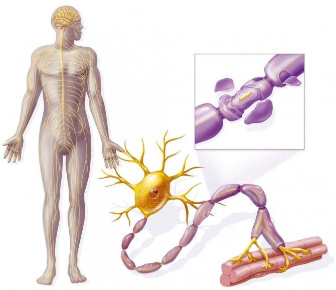 Боковой амиотрофический склероз - причины и признаки бокового амиотрофического склероза