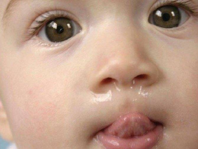 Кашель и сопли у ребенка без температуры при прорезывании зубов у детей